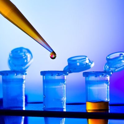 Urine Analyzer