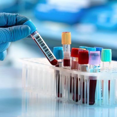 Photometry Analysis is used to indirectly measure the concentration of analyte present in the sample.